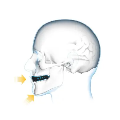 Protège-dents Shock Doctor Gel Max Transparent